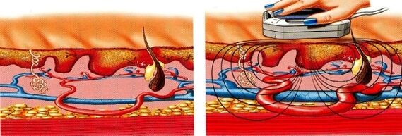 ha elzsibbad a lába